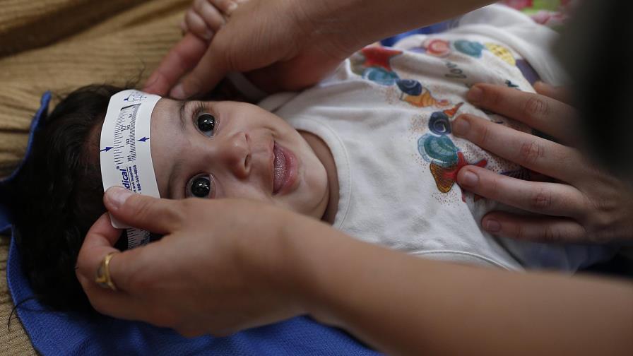 Zika podría causar más deficiencias además de microcefalia Zika podría causar más deficiencias además de microcefalia