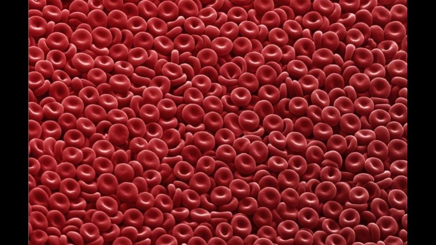 Los cánceres de mama, ovarios, páncreas y sangre pueden detectarse a tiempo mediante un examen