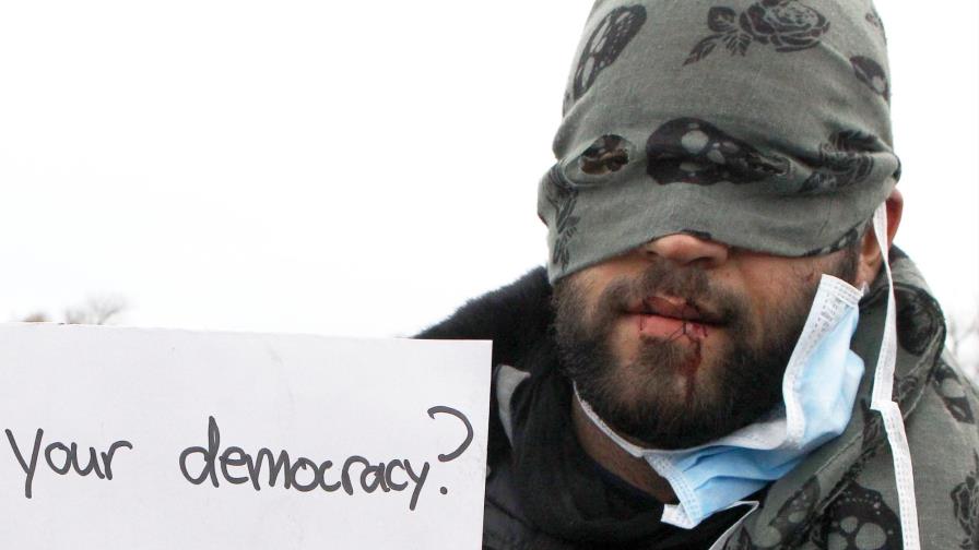 Una decena de inmigrantes iraníes se cose la boca en la jungla de Calais