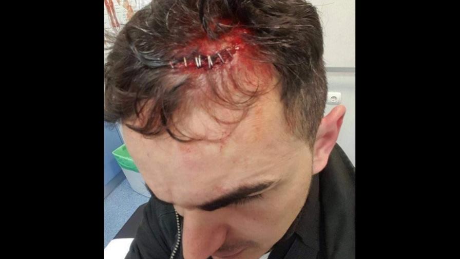 Trifulca en Madrid deja catorce policías heridos, señalan pandilla de dominicanos