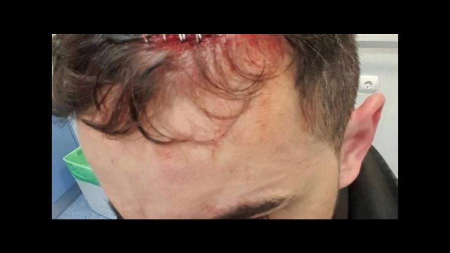 Embajada dominicana en España lamenta trifulca entre criollos y policías