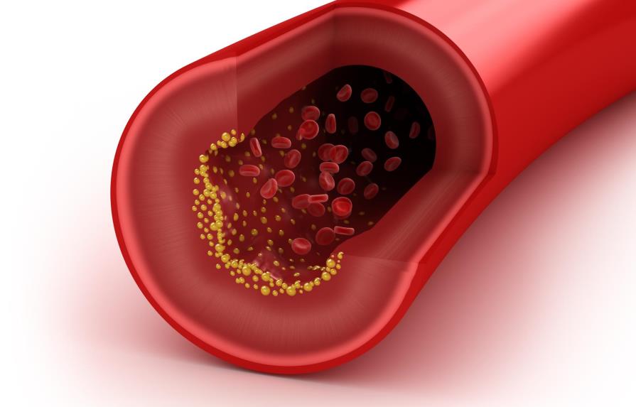 El colesterol bueno no siempre sirve para proteger el corazón, según estudio