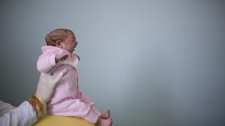 Riesgo de microcefalia asociada al zika es del 14 % en Brasil, según estudio