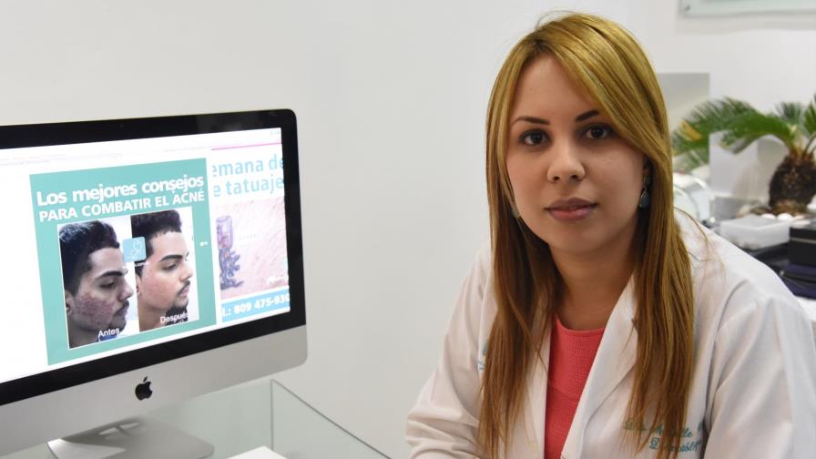 El acné ¿A quién afecta más?