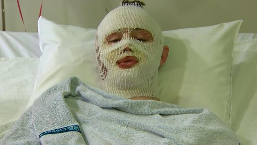 Joven de EEUU describe experiencia en ataque en Bruselas 