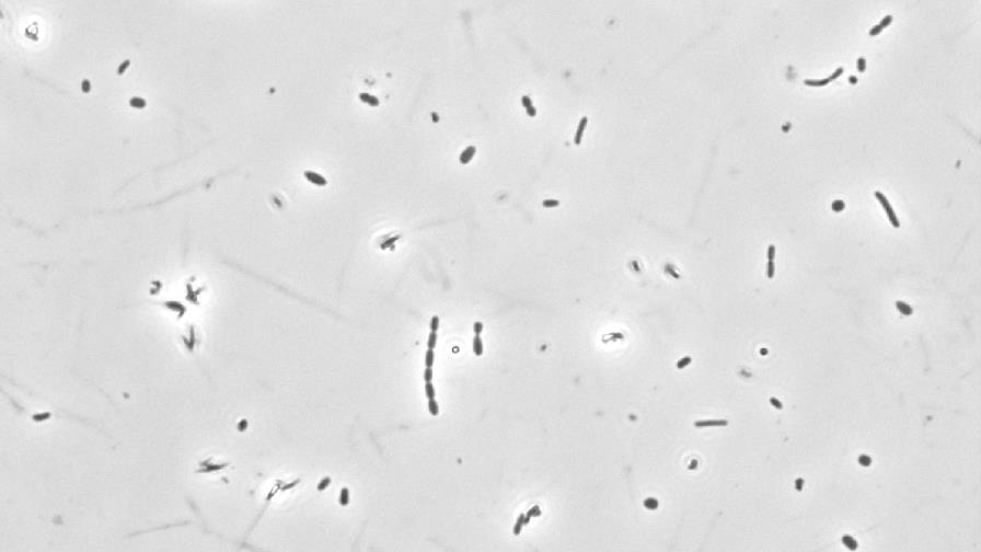 Alterar la microbiota de los enfermos de lupus mejora su respuesta inmune Alterar la microbiota de los enfermos de lupus mejora su respuesta inmune