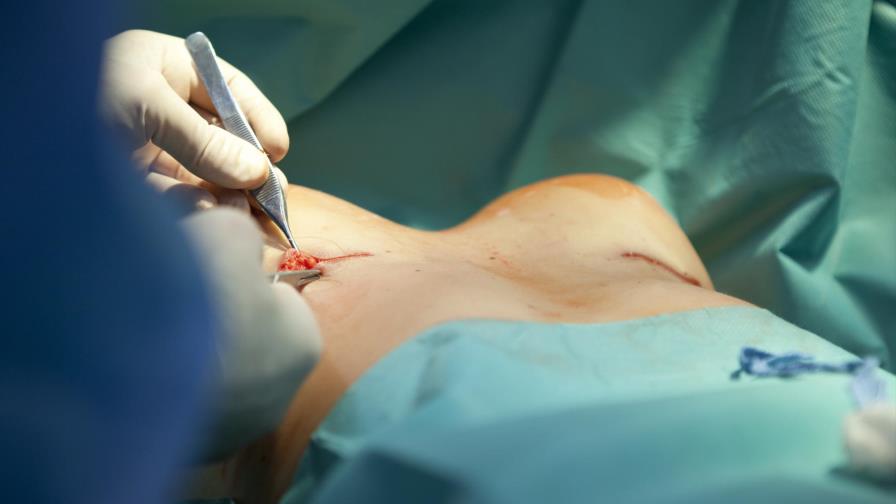 Está grave una dominicana que vino al país a someterse a cirugía plástica Está grave una dominicana que vino al país a someterse a cirugía plástica