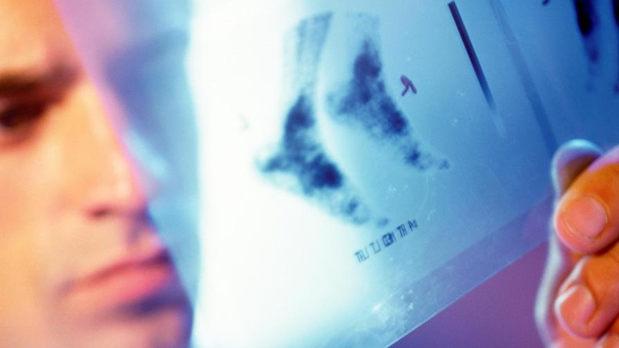 Una niña de diez meses murió tras recibir golpe en la cabeza