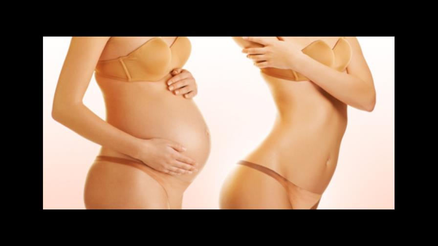 ‘Mommy Makeover’