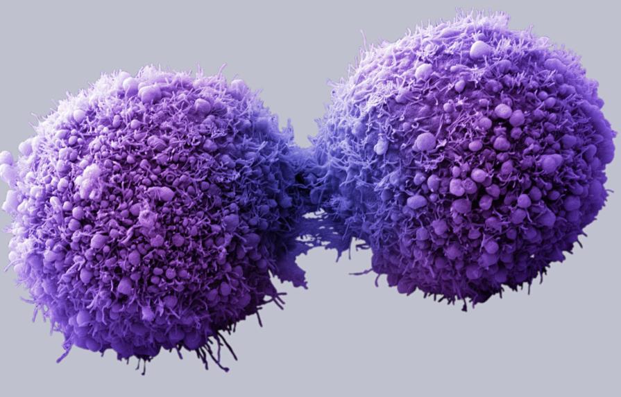 Científicos de EEUU consiguen que las células cancerígenas se autodestruyan