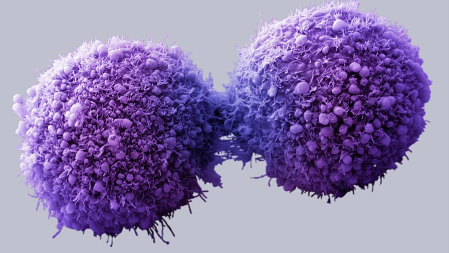Científicos de EEUU consiguen que las células cancerígenas se autodestruyan