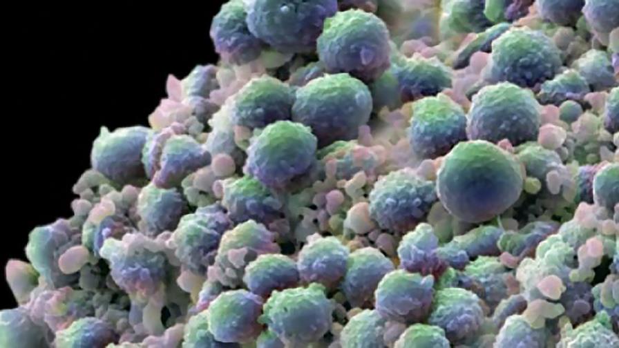 Identifican mecanismo causa metástasis en cáncer próstata