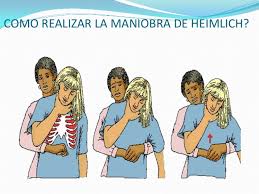 ”Maniobra de Heimlich”,