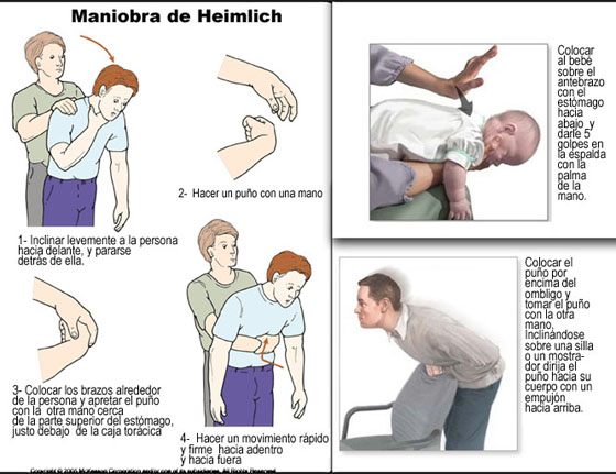 Primeros auxilios 