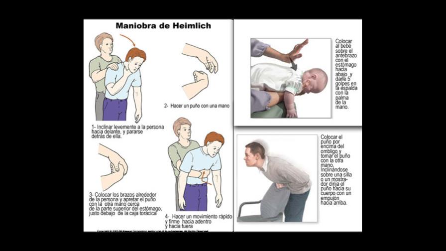¿Sabe qué hacer si su hijo se atraganta con un objeto?  