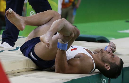 Vídeo: Gimnasta francés se parte la pierna durante participación en Juegos de Río