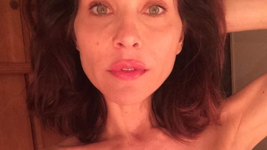 Actriz Lorena Meritano dice que sobrepasó el cáncer y muestra secuelas del proceso