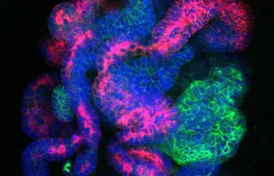 La ciencia da paso más hacia la posibilidad de crear riñones trasplantables