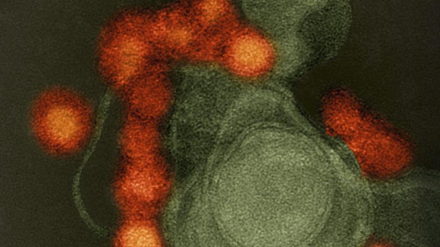 FDA recomienda someter a pruebas de detección del Zika toda la sangre donada en Estados Unidos FDA recomienda someter a pruebas de detección del Zika toda la sangre donada en Estados Unidos