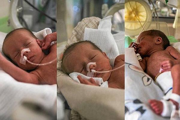Amelia, Laura y Oliva, las trillizas idénticas que nacieron en Polonia