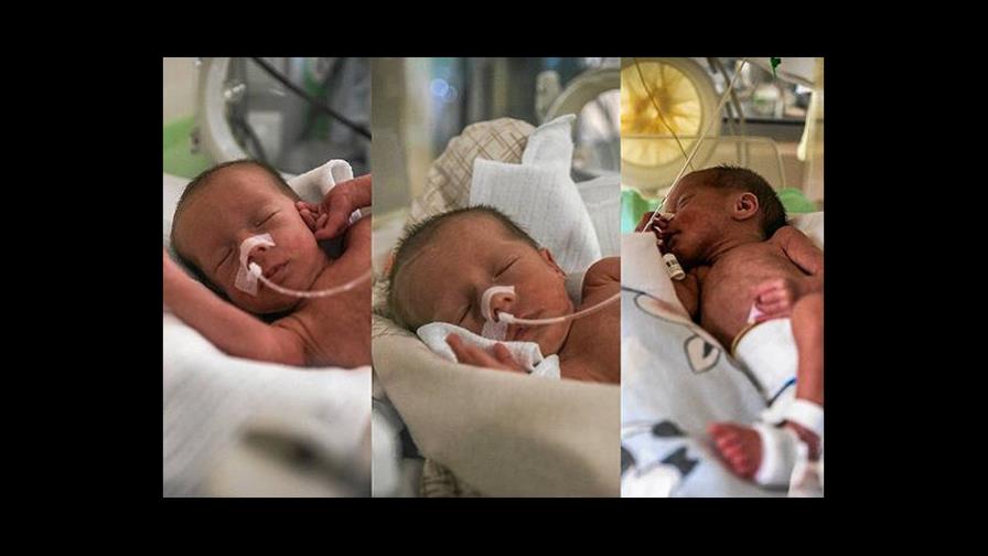 Amelia, Laura y Oliva, las trillizas idénticas que nacieron en Polonia