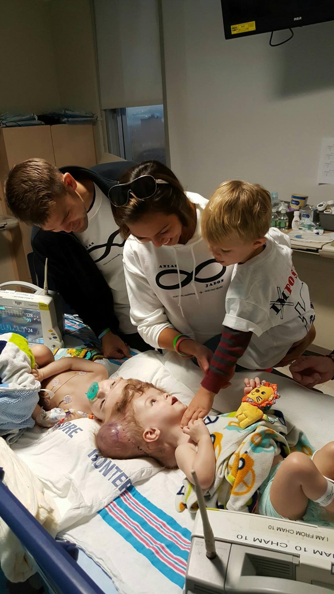 Jadon y Anias nacieron unidos por la cabeza el 9 de septiembre.