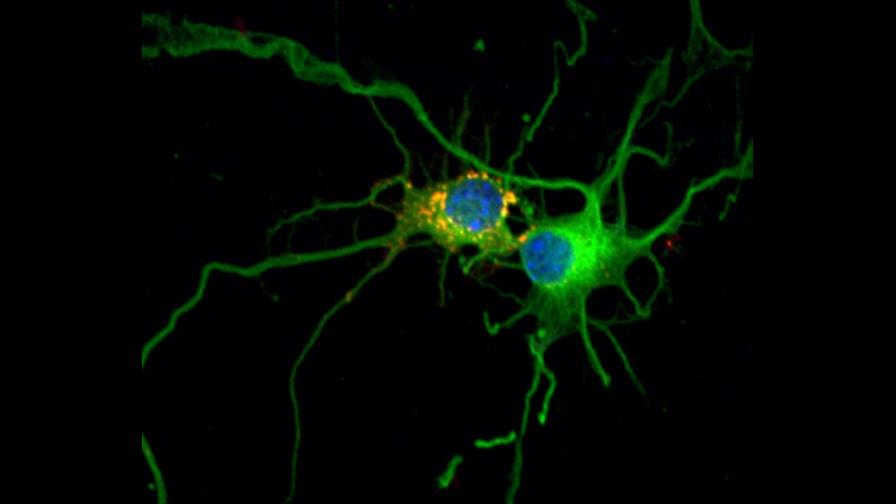 Lafora, el tipo de epilepsia más severa en humanos