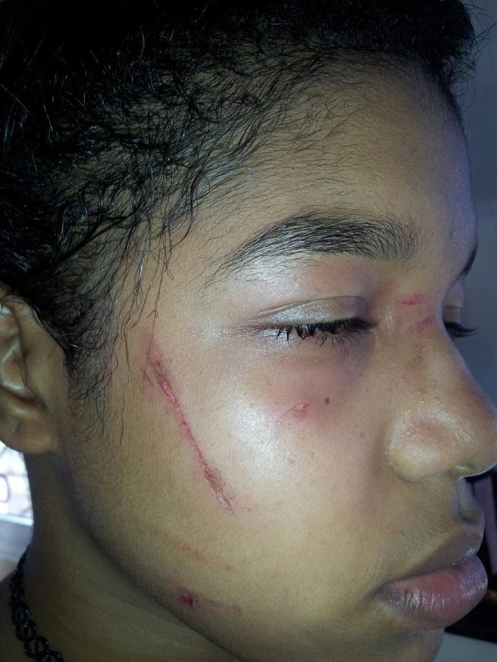 Menor maltratada al salir del Colegio Gastón Fernando Deligne en San Pedro de Macorís.