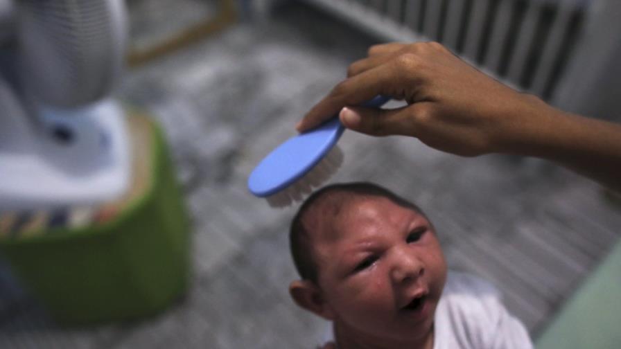 Dirección de epidemiología registra 28 casos de microcefalia asociados al virus del zika