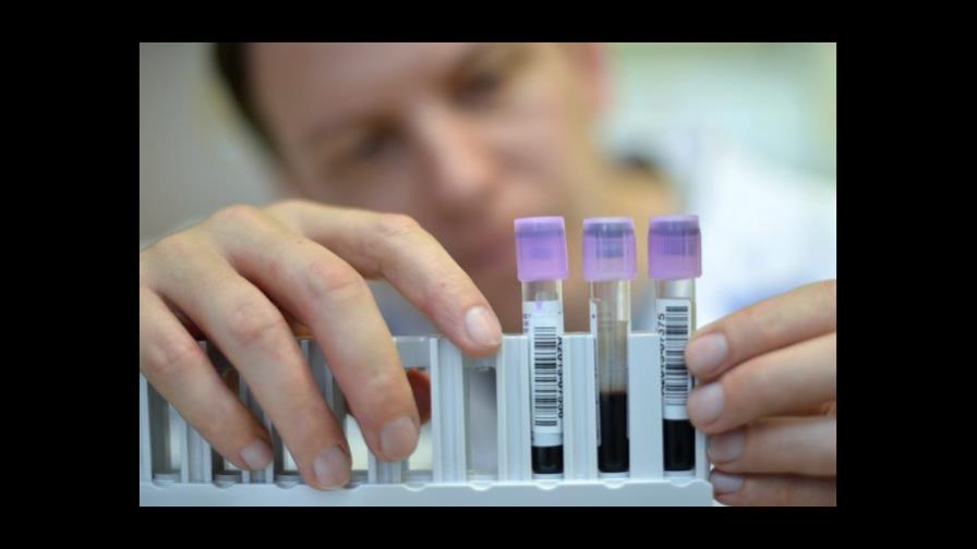 Historia genética de un linfoma predice su evolución