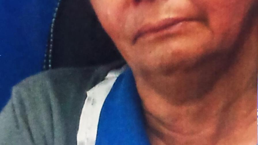 Procurador Jean A. Rodríguez cancela fiscal de Higüey por golpear a conserje Procurador Jean A. Rodríguez cancela fiscal de Higüey por golpear a conserje