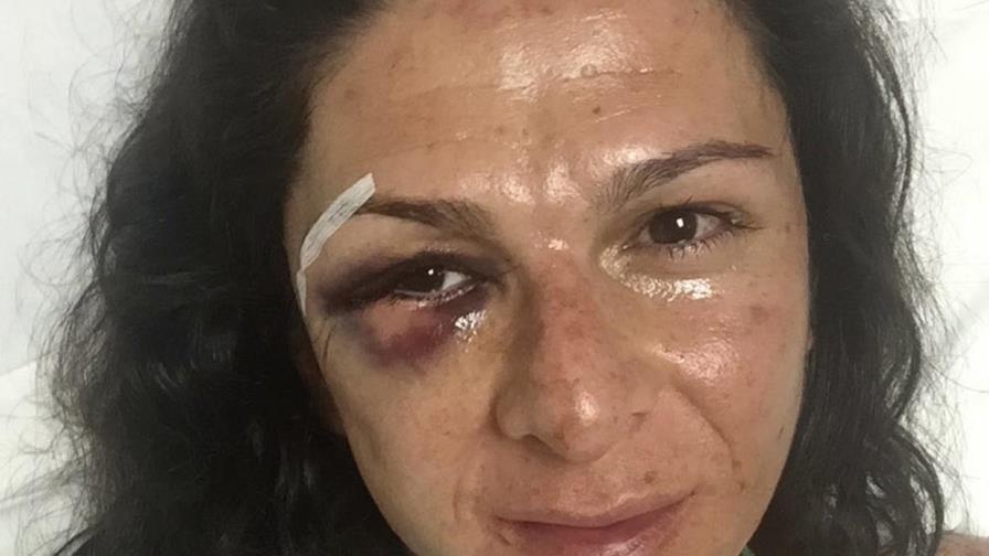 Exatleta y senadora mexicana recibe golpiza 