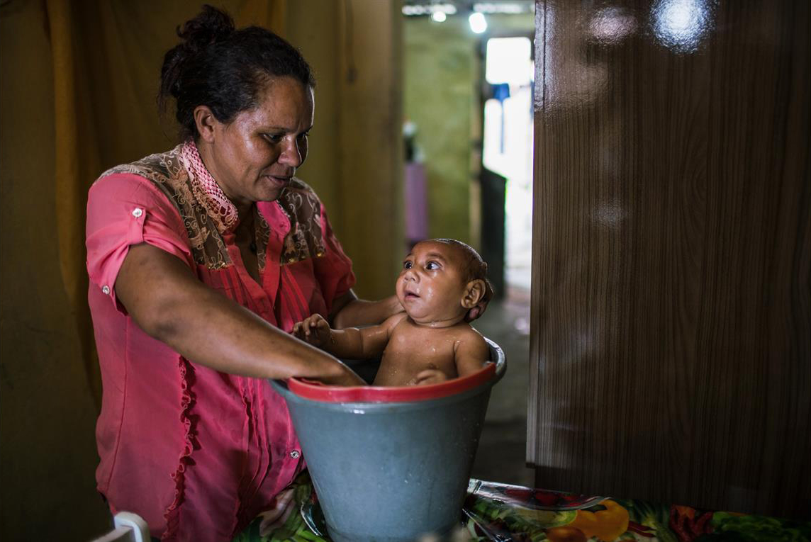 El 30 de enero Solange Ferreira baña a su hijo José Wesley, con microcefalia, en un balde en su casa en Bonito, Estado de Pernambuco, Brasil.