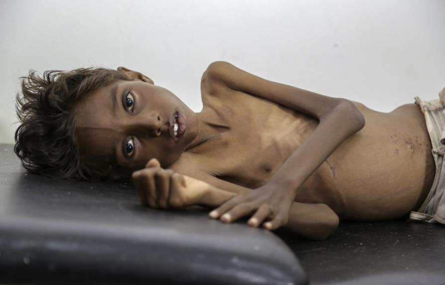 Millones de niños padecen inanición en Yemen debido a guerra 