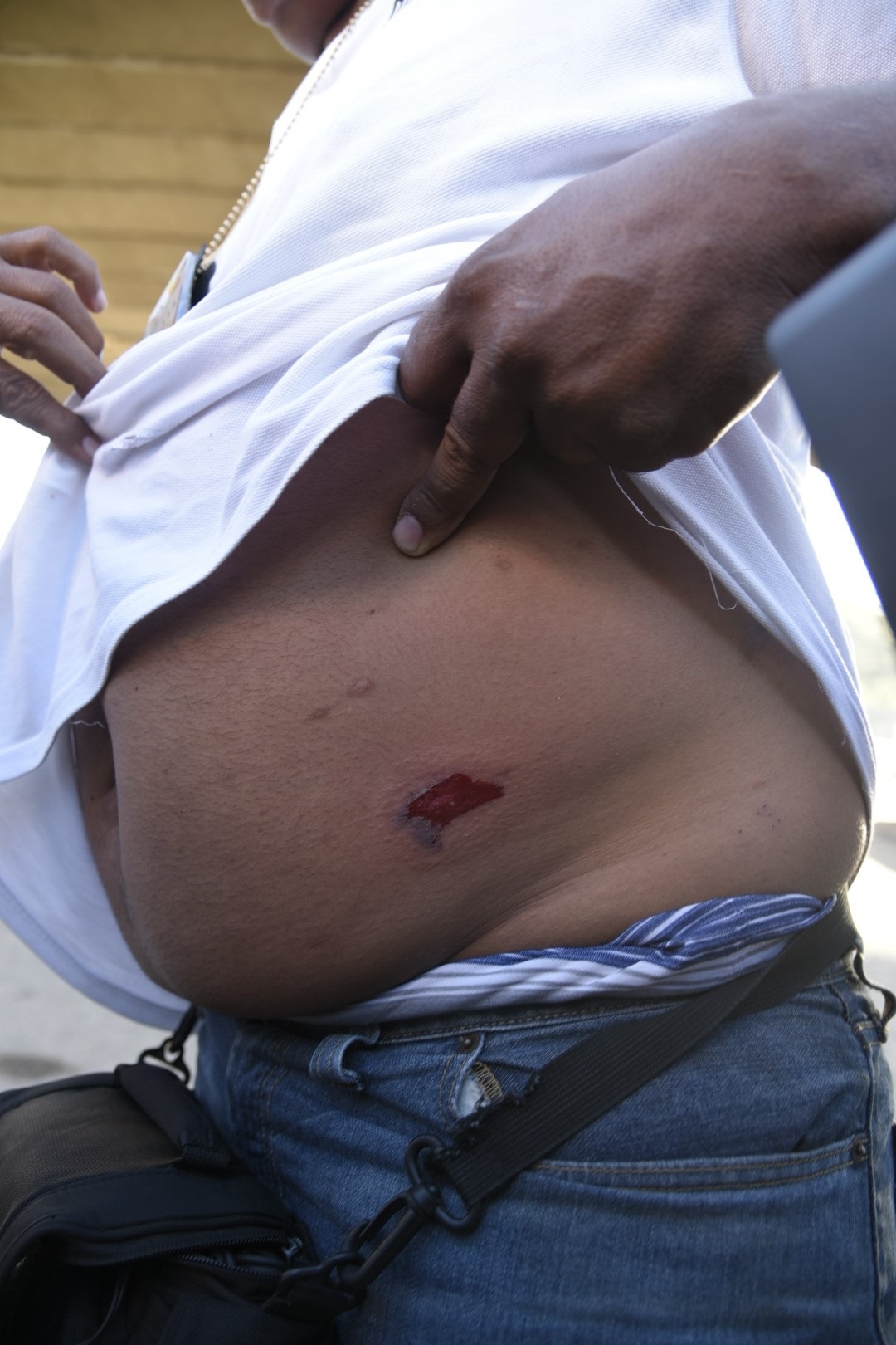 El camarógrafo herido durante la protesta de choferes de la ruta “M” o Circunvalación en reclamo del arreglo de esa vía y de la avenida Salvador Estrella Sadhalá.