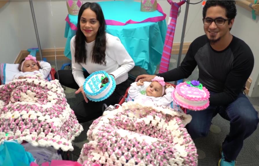 Celebran el primer cumpleaños a las siamesas separadas en Nueva York