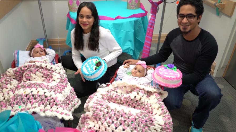 Celebran el primer cumpleaños a las siamesas separadas en Nueva York