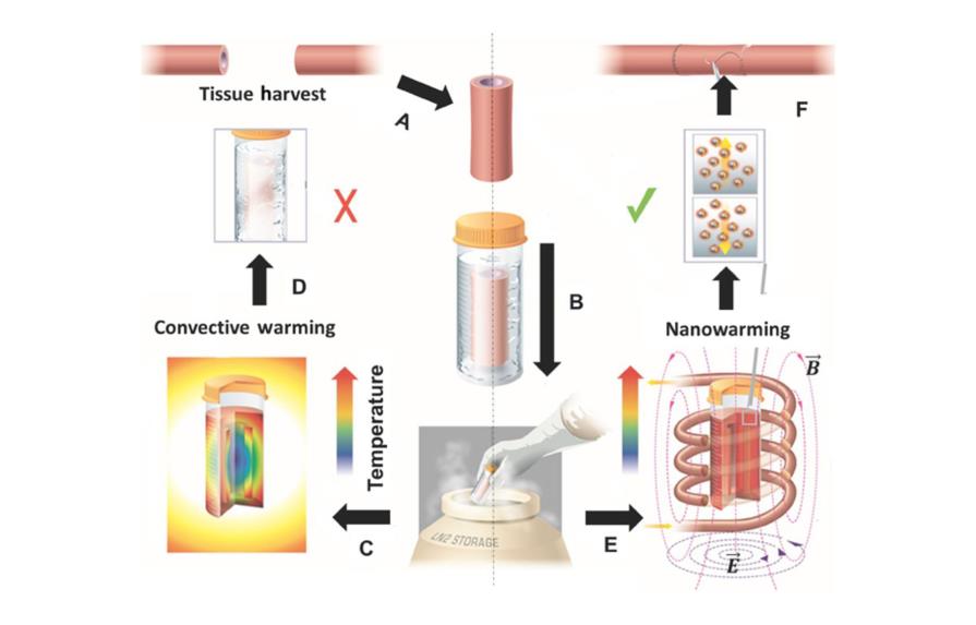 Nanopartículas podrían ayudar a crioconservación de órganos para trasplantes