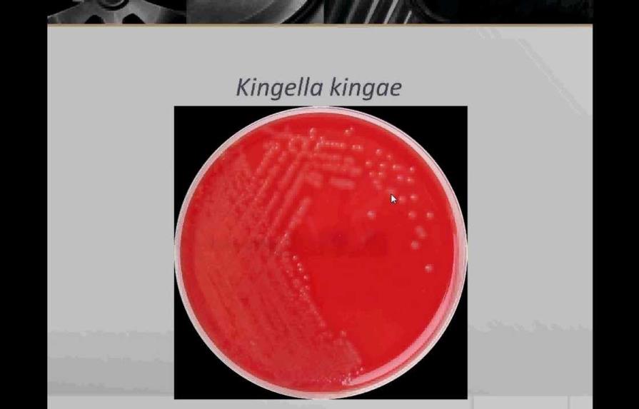 Infección por Kingella-Kingae
