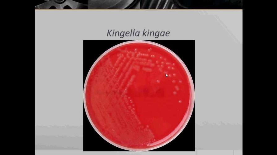 Infección por Kingella-Kingae