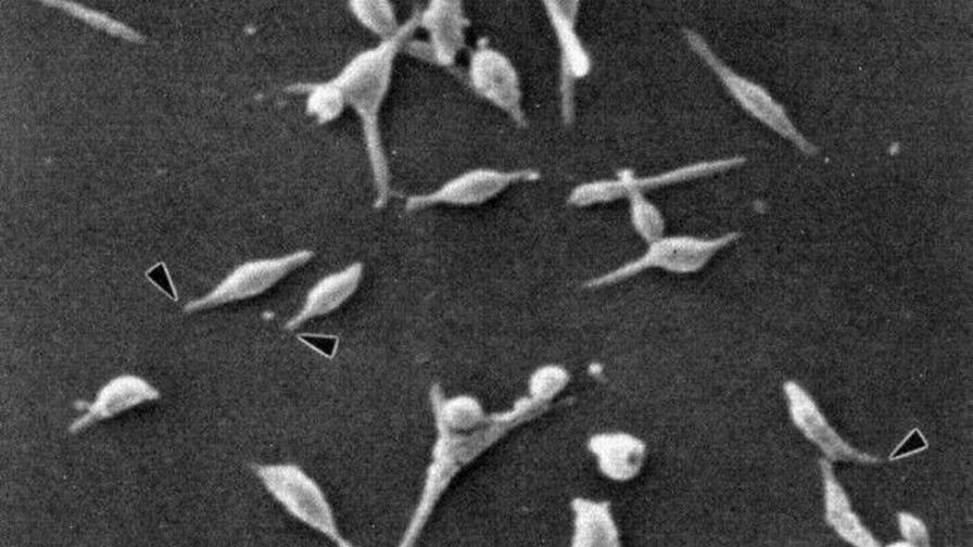 Descubren cómo son las estructuras del ADN en bacterias diminutas