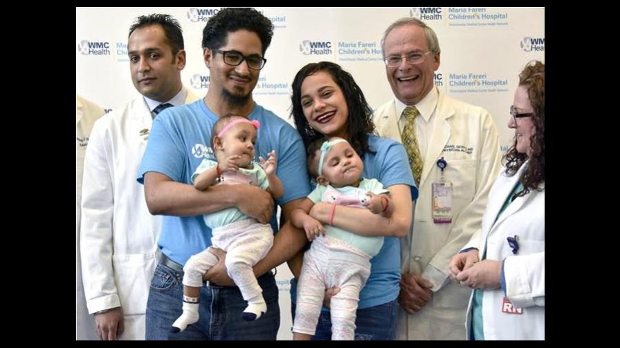 Dan de alta a siamesas separadas, pero no tienen hogar en República Dominicana