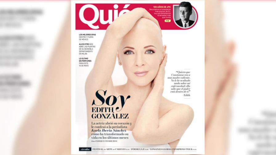Actriz Edith González sin cabello habla de su lucha contra el cáncer 