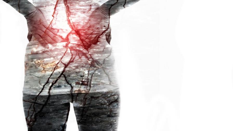 Fibromialgia: la enfermedad misteriosa Fibromialgia: la enfermedad misteriosa