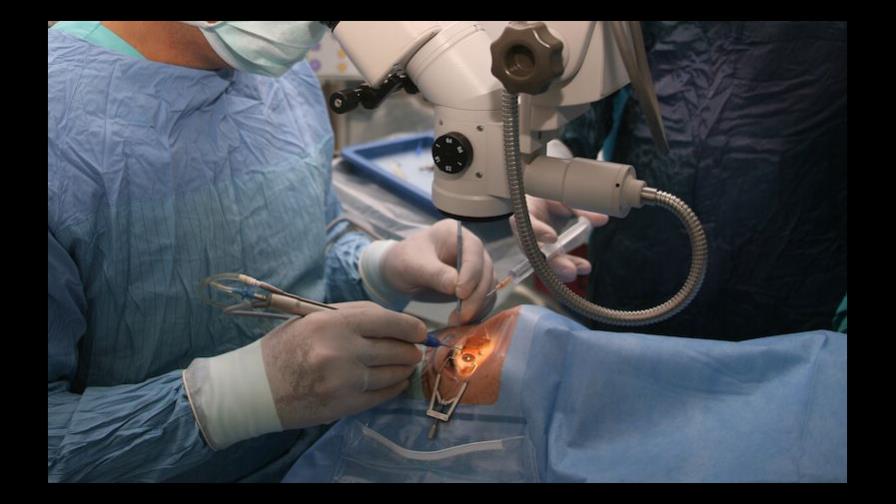 Médicos de EE.UU. llegan a Moca a practicar más de cien cirugías de cataratas