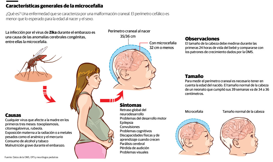 Microcefalia Expectativa De Vida - LIBRAIN