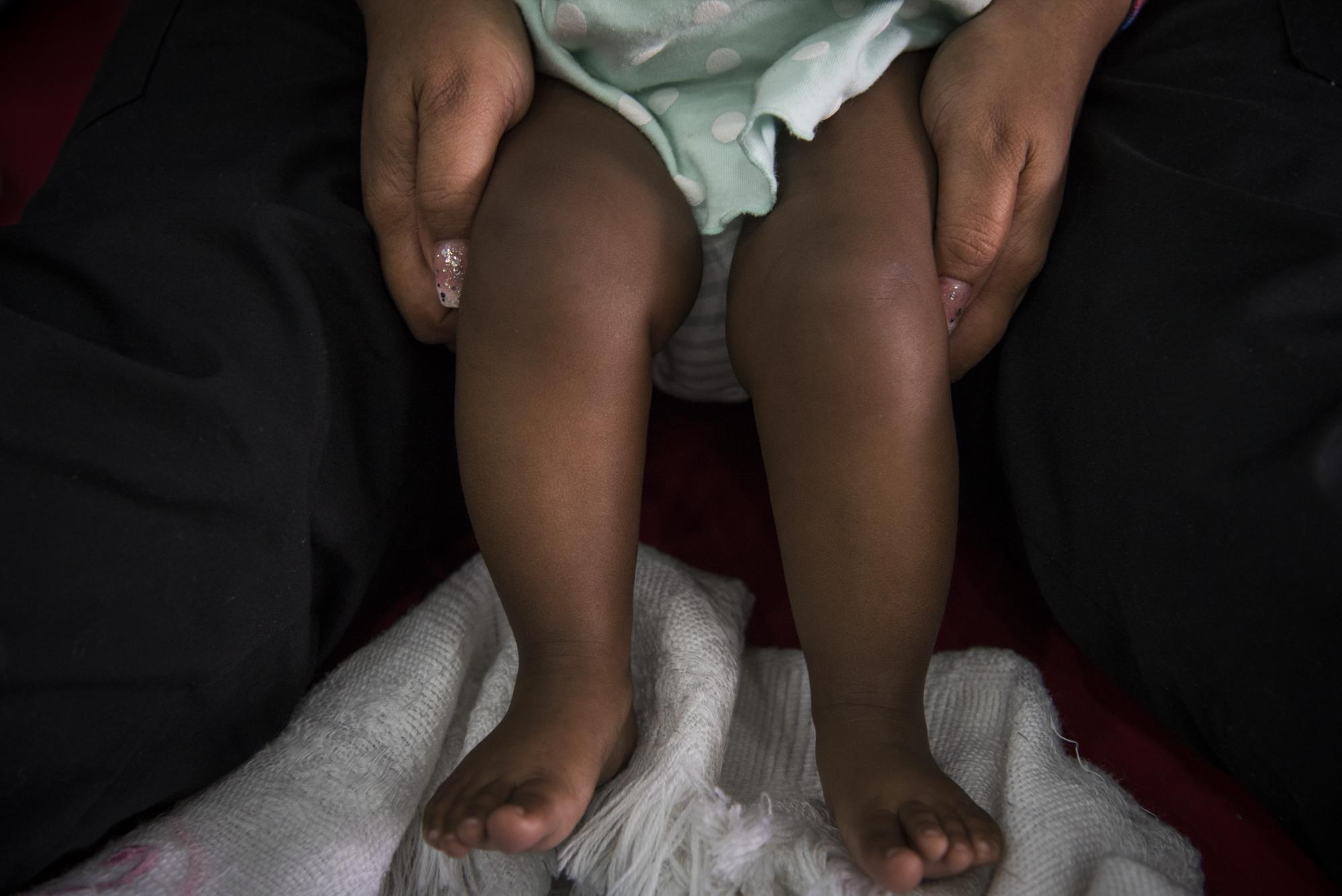 Nashla druante una de sus terapias. 