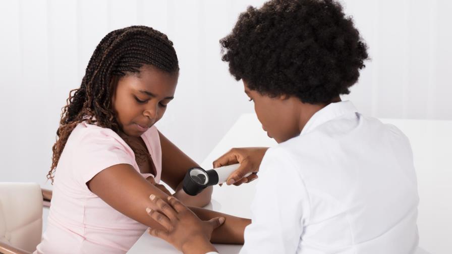 Logran predecir la metástasis del melanoma y encuentran una diana terapéutica 