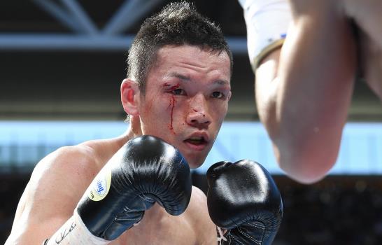 Manny Pacquiao considera que el boxeo no debe morir por una decisión “injusta y oficialista” 