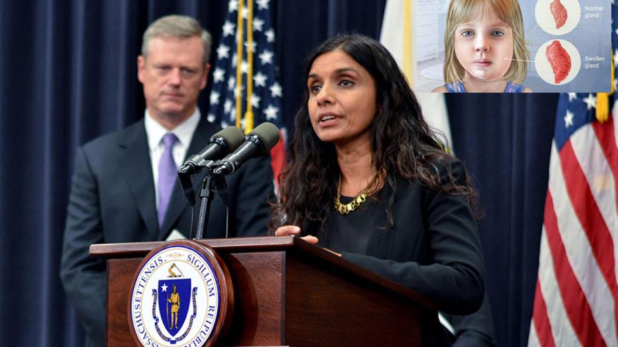  Exhortan a dominicanos vacunarse  por  brote de paperas en Boston